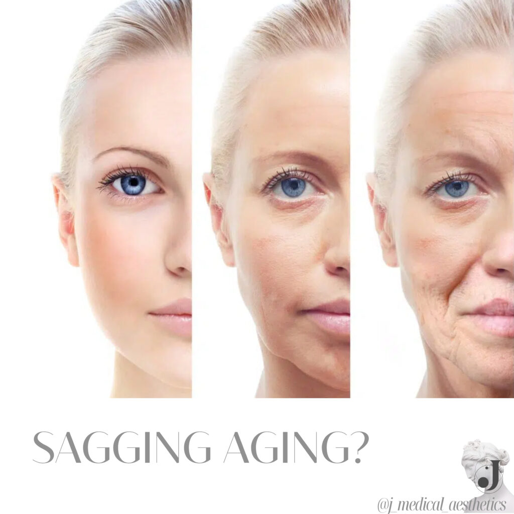 An image illustrating the effectiveness of HIFU in addressing sagging skin and signs of aging