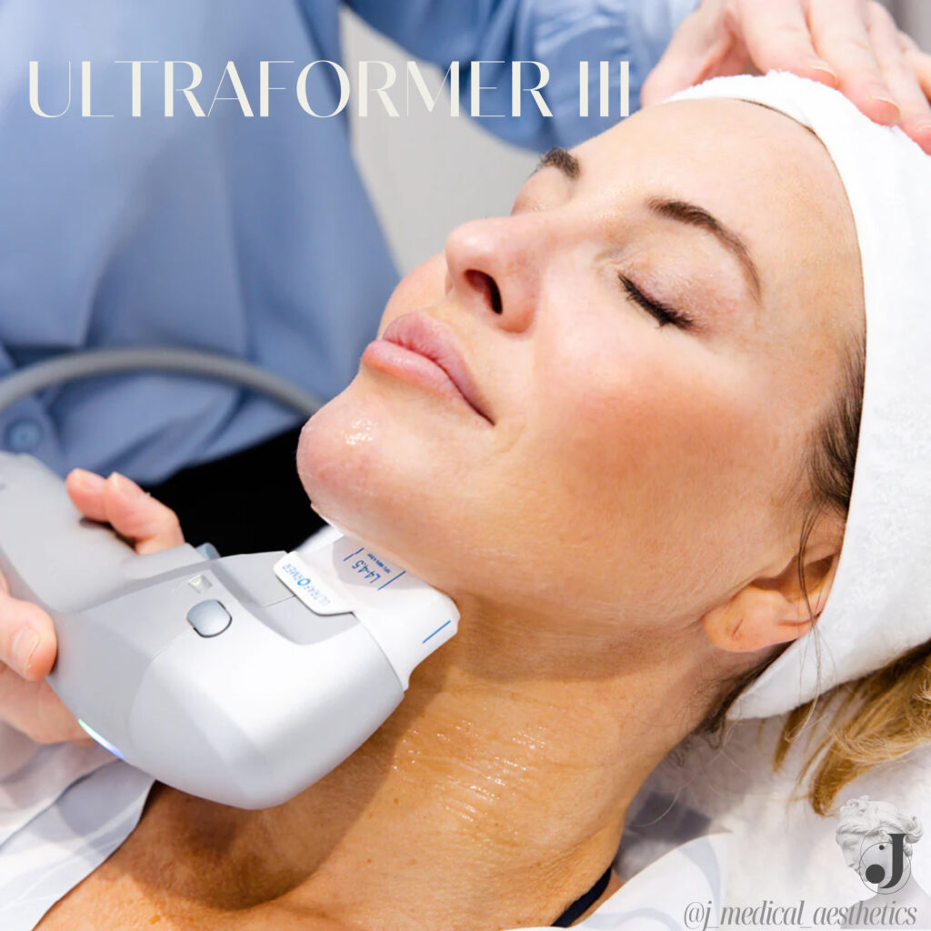 An image depicting HIFU treatment targeting the neck area for firmer more youthful looking skin